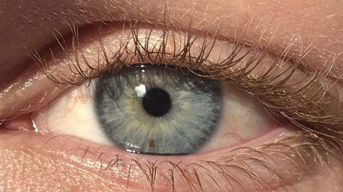 Girl Gouges Out Eyes S. Carolina woman gouges out her eyes while high to get closer to God